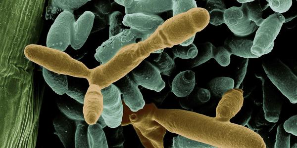 Microbes, Credit: Manpreet Dhami, Tadashi Fukami and Lydia-Marie Jouber